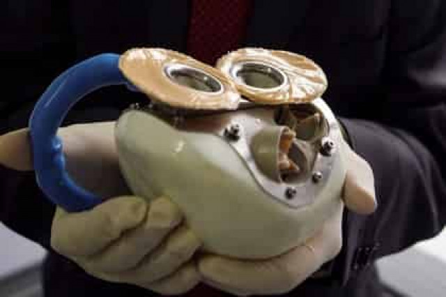 Во Франции умер второй обладатель искусственного сердца