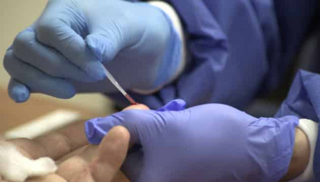 Ukrainian army reports 44 coronavirus cases