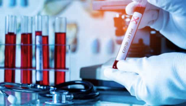 Ukraine reports 12,585 new COVID-19 cases