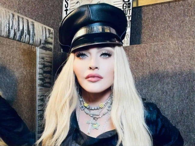 64-річну Мадонну знайшли без свідомості: що відомо про стан співачки
